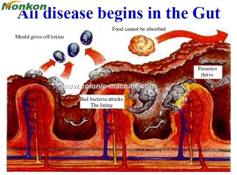 How to Clean Your Colon?