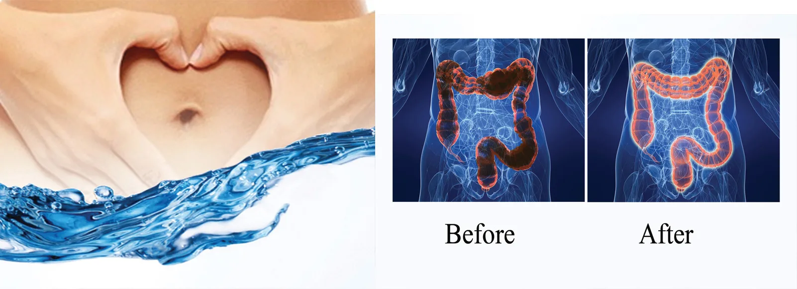 What is the cost of a colonic cleansing?